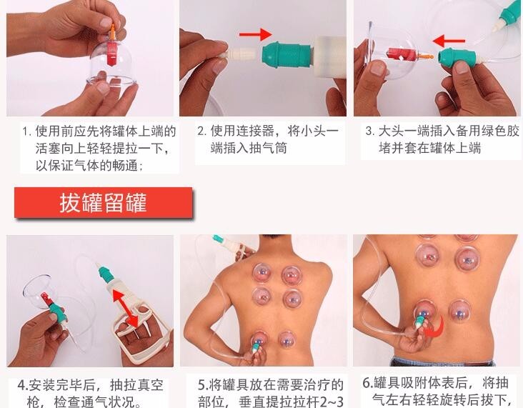 Juego de ventosas para terapia corporal - Imagen 3